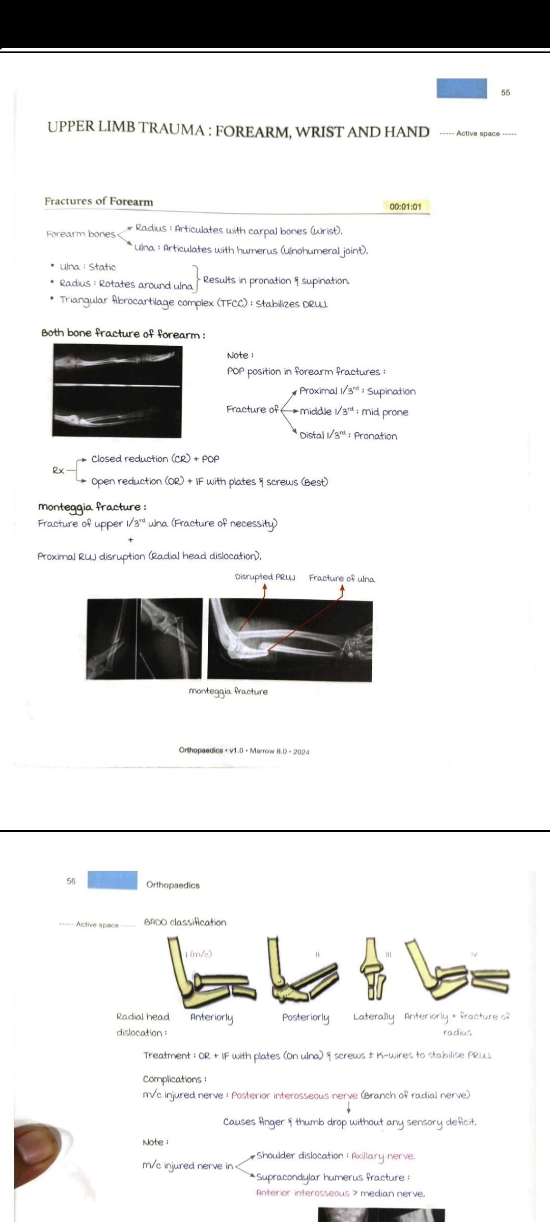 Photo of a course on  Forearm, Wrist, and Hand Trauma