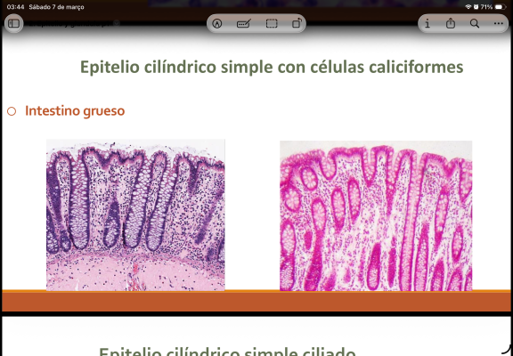 Photo of a course on  Simple Columnar Epithelium Overview